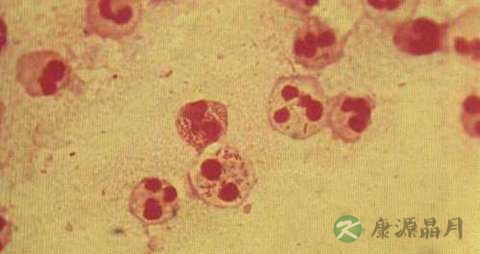 淋病奈瑟菌会引起什么疾病