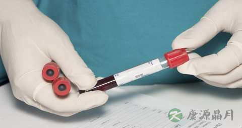 验血可以查出艾滋病吗