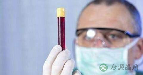 艾滋病后遗症怎么治疗