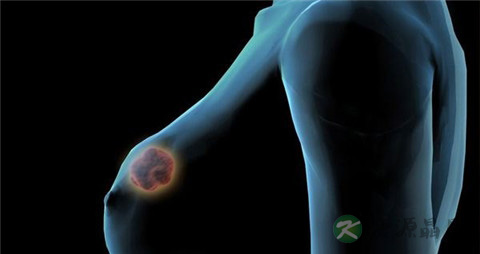 乳腺囊性增生和乳腺增生的区别