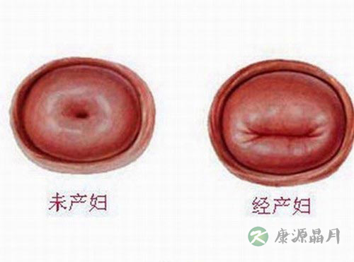 高清全图：美女处女膜的结构
