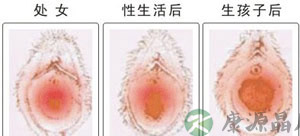 神秘的“处女膜”与处女有关系吗