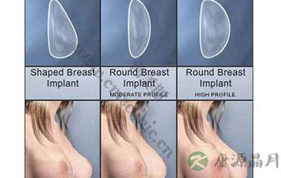 图解：女性乳房“勃起”过程图