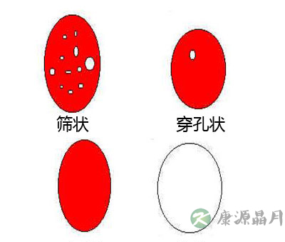 图解处女膜：在哪儿，长啥样？