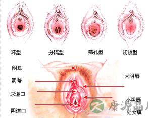 处女膜有多厚？为什么捅不破？