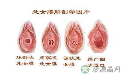 放大五倍的处女膜实拍图！