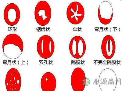 内有瞎眼图：一起来看真人处女膜