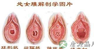 高清全图：美女处女膜的结构