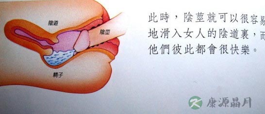 图解：健康女性的10种阴户类型
