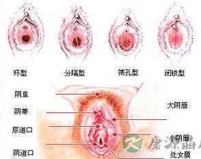 专家图解：健康女性的私处类型