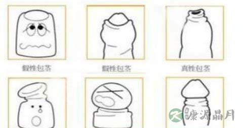 包皮过长的危害有哪些