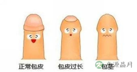 不能晨勃怎么回事
