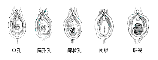 内有瞎眼图：一起来看真人处女膜