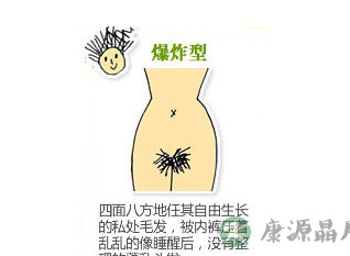 图解史上最全女性私处毛发形状