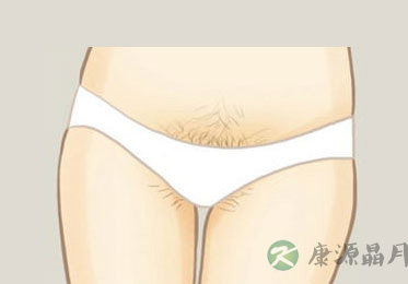 图解史上最全女性私处毛发形状