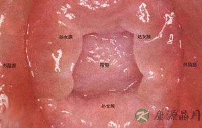 高清图片：5倍放大女人深藏处女膜