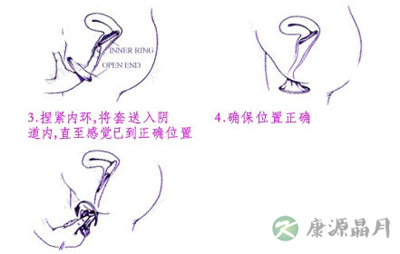 女用避孕套的用法（图）