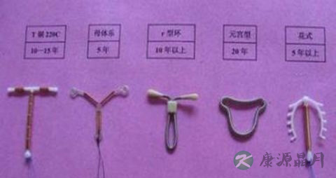 避孕环的种类名称
