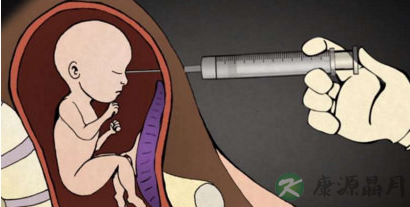 堕胎的几种方法 女生一定要知道