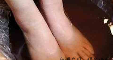 小寒为什么要喝腊八粥