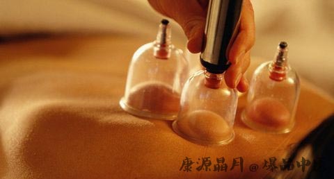 三伏天拔罐有什么好处