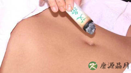 夏天艾灸注意事项