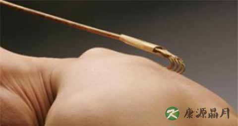 冬天皮肤瘙痒怎么办