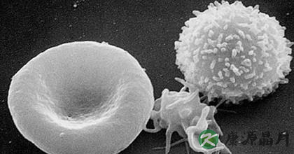 出现血小板减少吃什么好 出现血小板减少吃什么好