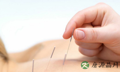 中医针灸怎样减肥? 中医针灸怎样减肥?