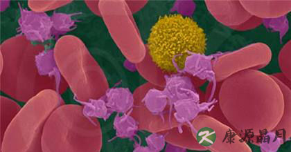 出现血小板减少吃什么好 出现血小板减少吃什么好