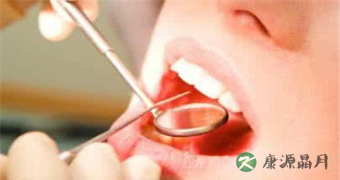 冷光美白后如何保护牙齿