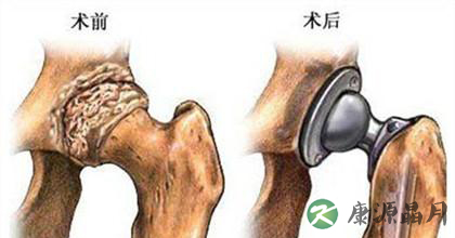 介入治疗的优势与不足