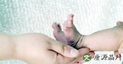 热水泡脚的好处与适宜人群 热水泡脚的好处与适宜人群