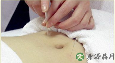 针灸减肥的五大减肥误区