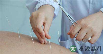 针灸副作用以及避免方法