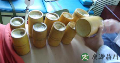 拔罐的主要作用原理