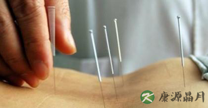 针灸治疗腰间盘突出的效果 针灸治疗腰间盘突出的效果