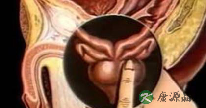 按摩前列腺有什么作用 按摩前列腺有什么作用