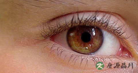 经常眨眼睛好吗