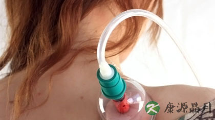 真空拔罐的使用方法