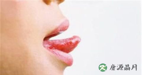 舌苔厚白小心是胃寒的症状！