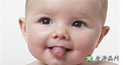 舌苔厚白小心是胃寒的症状！