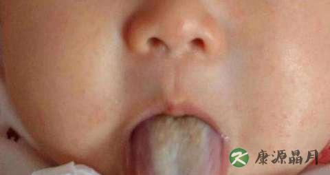 舌苔黄厚怎么回事