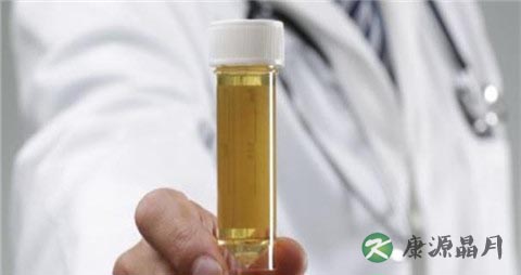 酱油尿是什么原因引起的