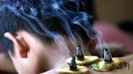 盘点：有多少灸法可以保健