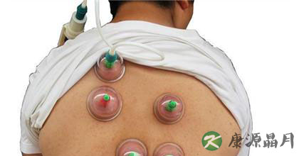 真空拔火罐的优势与注意事项 真空拔火罐的优势与注意事项