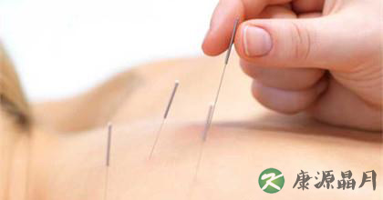 针灸治疗肩周炎的原理与方法