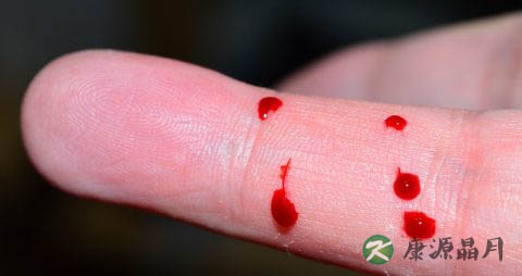 在哪能买到hiv检测试纸