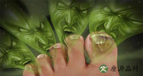 脚气用什么药好