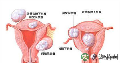 介入治疗的优势与不足